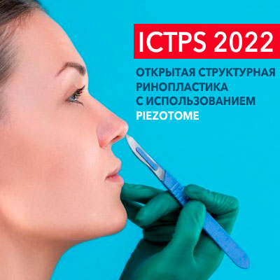 ICTPS 2022 – Открытая структурная ринопластика с использованием PIEZOTOME