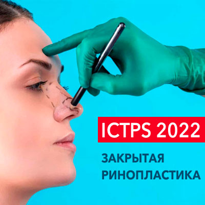 ICTPS 2022 – Закрытая ринопластика